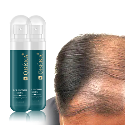 80ml Herbal Anti Rambut Runtuh Kembali Rambut Pertumbuhan Serum untuk pencegahan rambut menipis