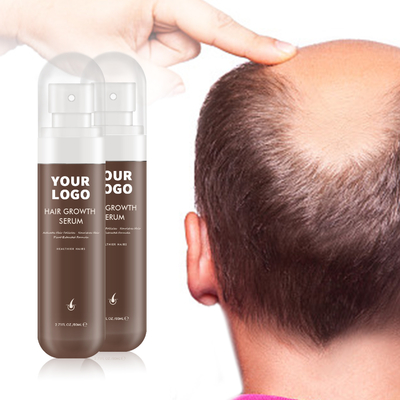100% Ekstrak Tanaman Murni Formula Serum Kulit Kepala Moisturizer untuk Kulit Kepala yang Kuat dan Sehat