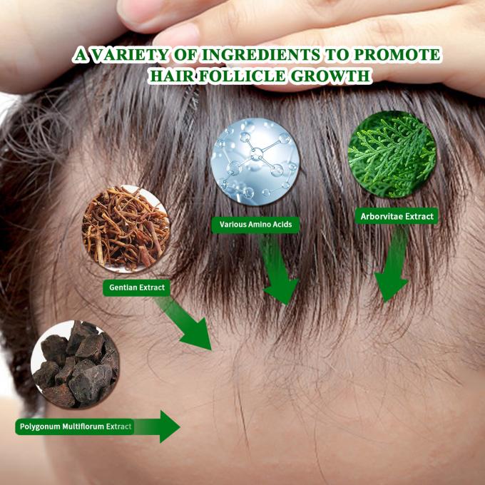 Serum Pertumbuhan Rambut Organik Penggunaan Eksternal Pengobatan Pertumbuhan Rambut Kembali Anti Rambut Rontok Spray 80ml 0