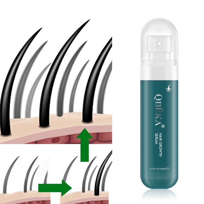 80ml Minyak Pertumbuhan Rambut Produk Label Pribadi Tim QC Profesional Serum Anti Rambut Rontok 0