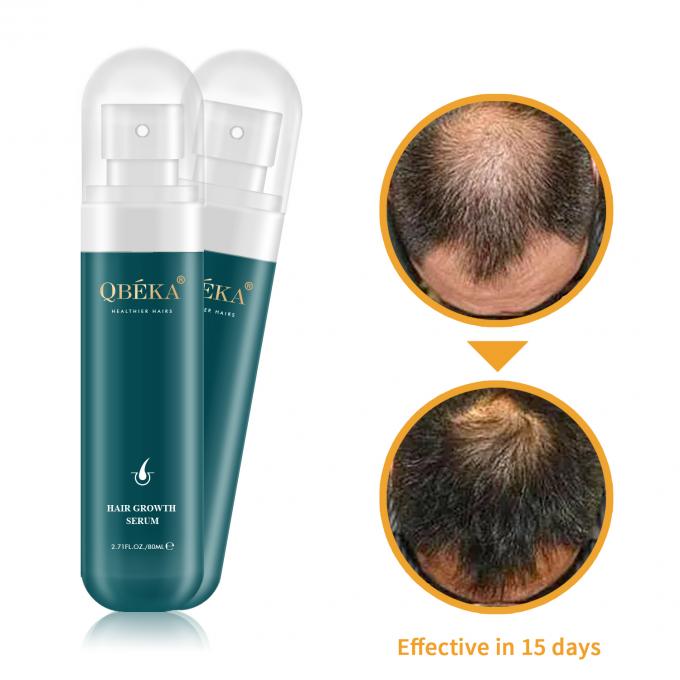 80ml Minyak Pertumbuhan Rambut Produk Label Pribadi Tim QC Profesional Serum Anti Rambut Rontok 1