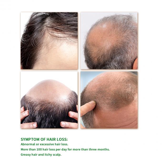 15 Tumbuhan Alami yang Jarang Mengekstrak Serum Pertumbuhan Rambut untuk Pengobatan Pribadi dengan Hasil Terbaik 1