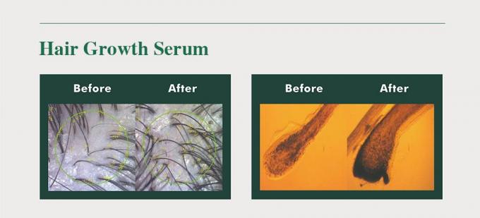 Herbal Hair Tonic untuk Pria Mencegah Kerontokan Rambut Menumbuhkan Rambut Volume 3 Bulan Supply 2