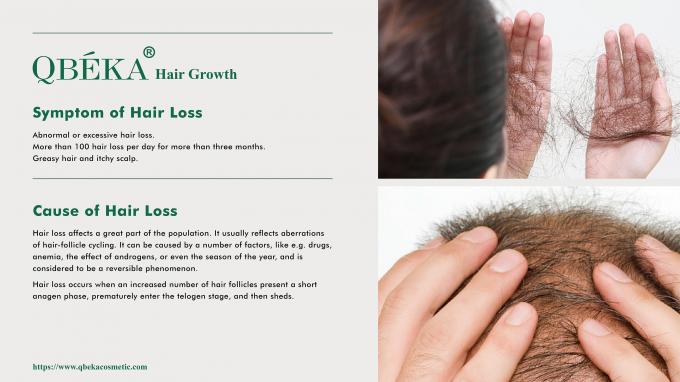 80 ml GMPC setiap hari Pengobatan standar untuk rambut rontok dan rambut rontok pada pria 0