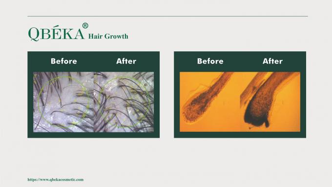80 ml GMPC setiap hari Pengobatan standar untuk rambut rontok dan rambut rontok pada pria 11