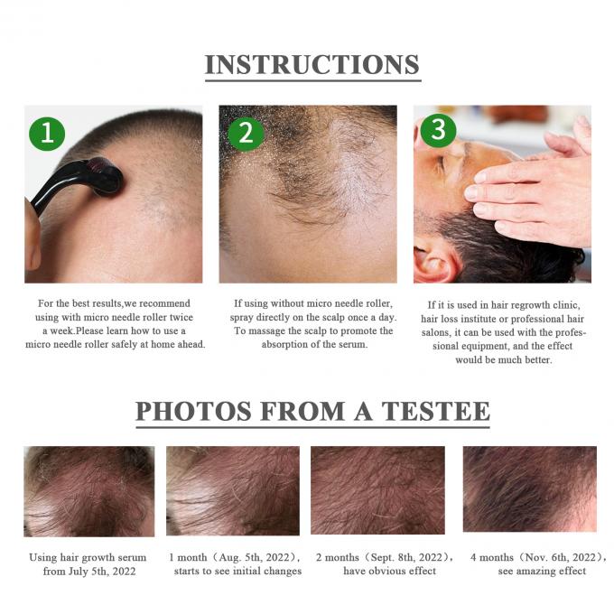Herbal 7-15 Hari Serum Pertumbuhan Rambut Memulihkan Volume dan bersinar ke rambut Anda dengan mudah 3