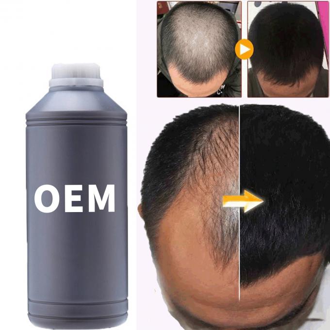 36 Bulan Shelf Life Hair Growth Booster Oil Serum Untuk Semua Jenis Rambut Perawatan Rambut Rontok 3