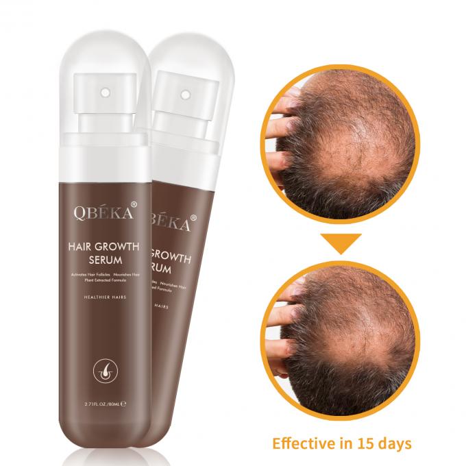 Bentuk Serum Asam Amino Rambut Rambut Rambut yang Lebih Panjang dan Lebih Tepuh Untuk Aktifisasi Folikel 2