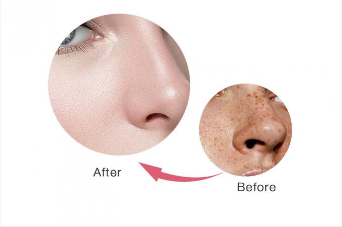 Retinol Facial Cream untuk Penghapusan Bintik-bintik Bau yang Disesuaikan dan Label Pribadi 8