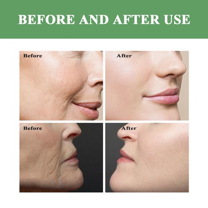 Toner Vitamin C Organik untuk Kulit Ringan Kering 100ml Aroma Disesuaikan Diterima 7