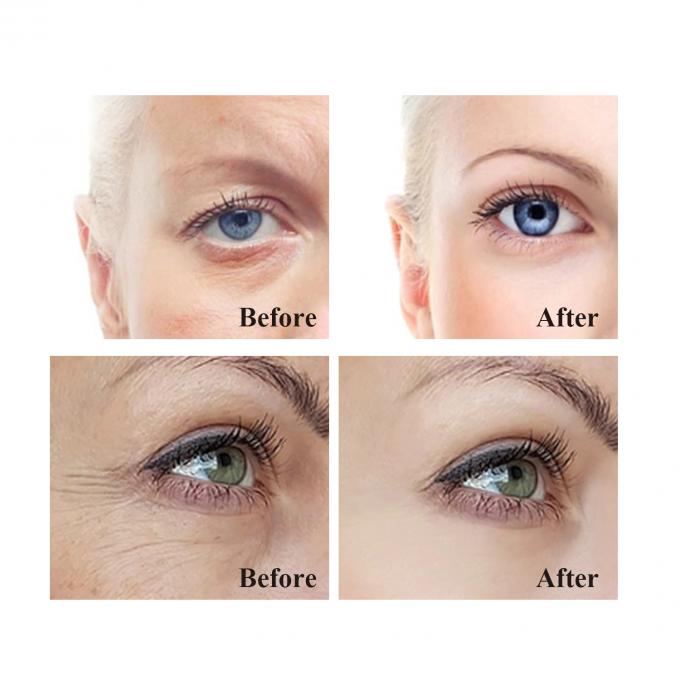 Anti-Wrinkle Eye Cream untuk lingkaran hitam dan bengkak 20ml Volume Eye Bag Removal Cream 9