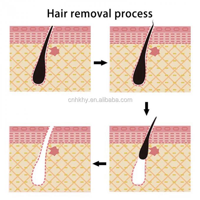Penghapusan rambut lembut untuk bagian intim ketiak kaki dan lengan Tidak ada iritasi atau kemerahan 8