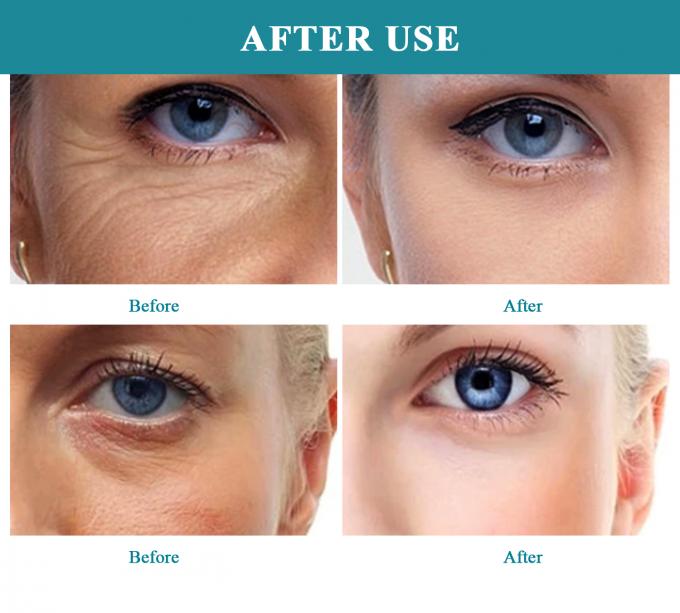Serum All-in-One Ringan untuk Hidrasi dan Menghilangkan Bintik-bintik Gelap Rumus yang Bisa Disesuaikan 4