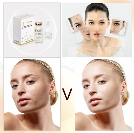 Ukuran biasa Vitamin C organik Pembersih Pembersih Anti Freckles Ampul Jumlah 1000 1