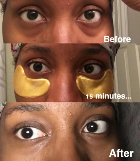 Sheet Form 24k Gold Collagen Eye Mask Solusi Utama untuk Garis Mata dan Kelelahan 6